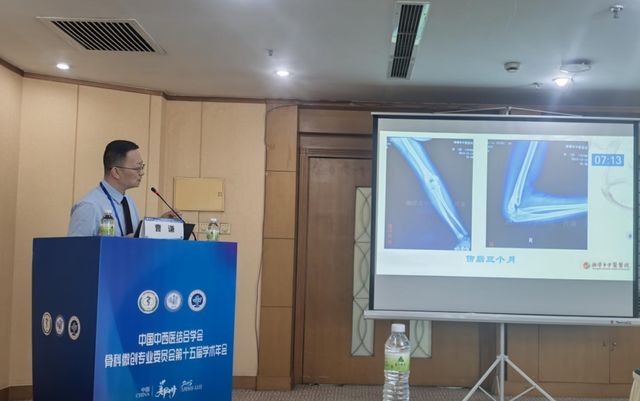 湘潭市中医医院产品展示骨伤科闪耀全国学术舞台